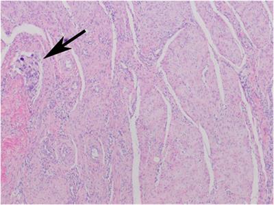 Bacterial Cellulose Properties Fulfilling Requirements for a Biomaterial of Choice in Reconstructive Surgery and Wound Healing